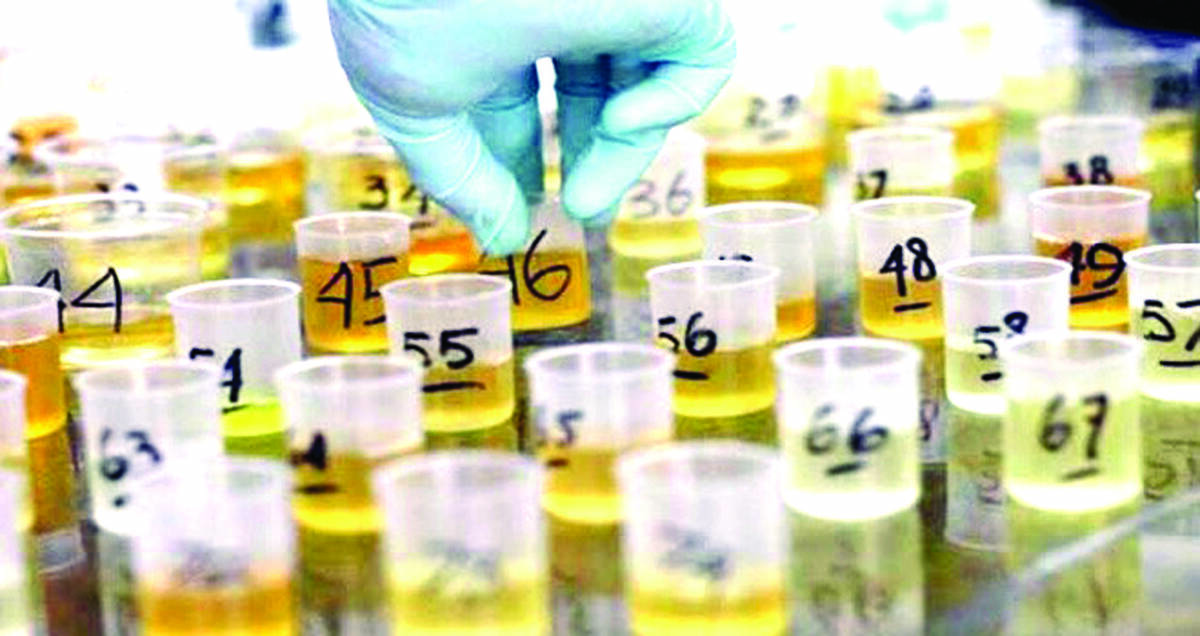 Anggota Polresta Jambi dan Jajaran Tes Urine
