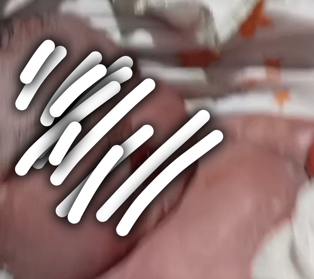 Bayi Meninggal dalam Kandungan Diduga Reaksi Suntikan Alergi Dokter Umum RSIA Milik Wali Kota Jambi