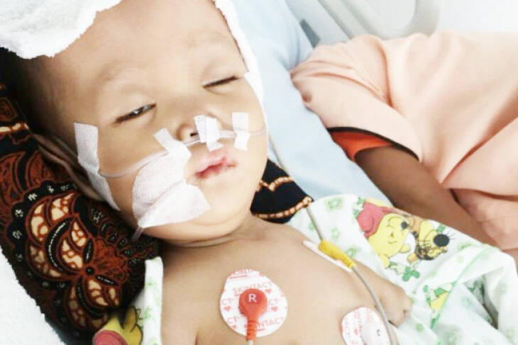 Bayi Penderita Peradangan Otak Butuh Biaya Pengobatan