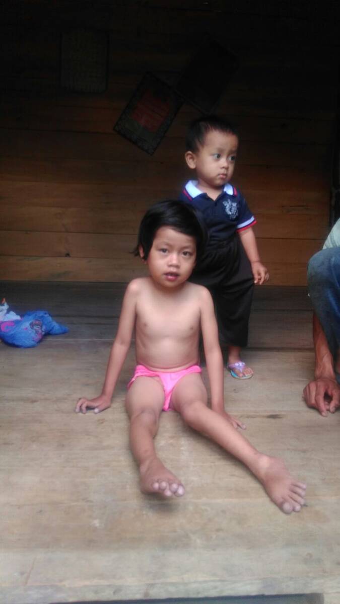Bocah Penderita Jantung Bocor Butuh Dana 400 juta