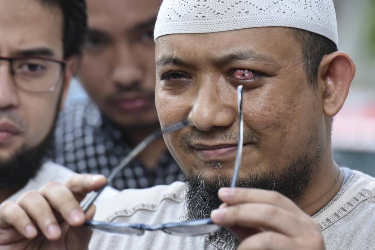 Borok Pimpinan KPK Dibongkar Novel Baswedan