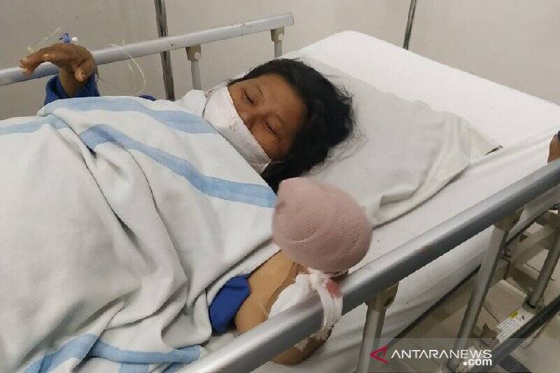 Erdina Korban Begal Sandiwara Potong Tangannya Sendiri