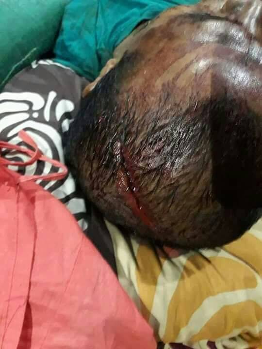 Jasad Azrol Warga Danau Embat Ditemukan Tewas Dengan Luka Bacok Di Kepala
