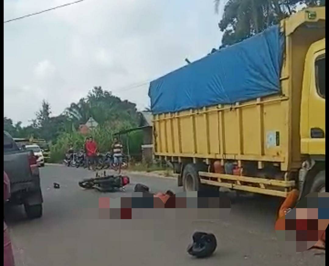 Laka Lantas Dengan Truck  Batubara Pengemudi SPM Mengalami Putus Kaki