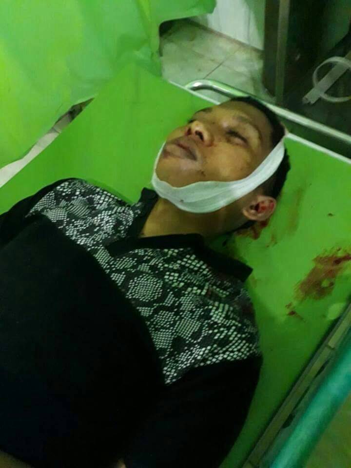 Laka Lantas, Pegawai FIF Meregang Nyawa