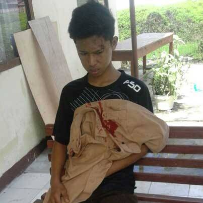 Ngaku Dikeroyok, Siswa SMA Lapor Polisi