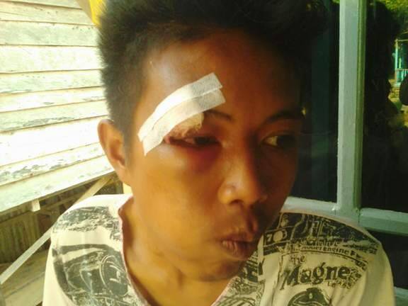 Salah Sasaran 8 Pemuda, Fendy Nyaris Tewas