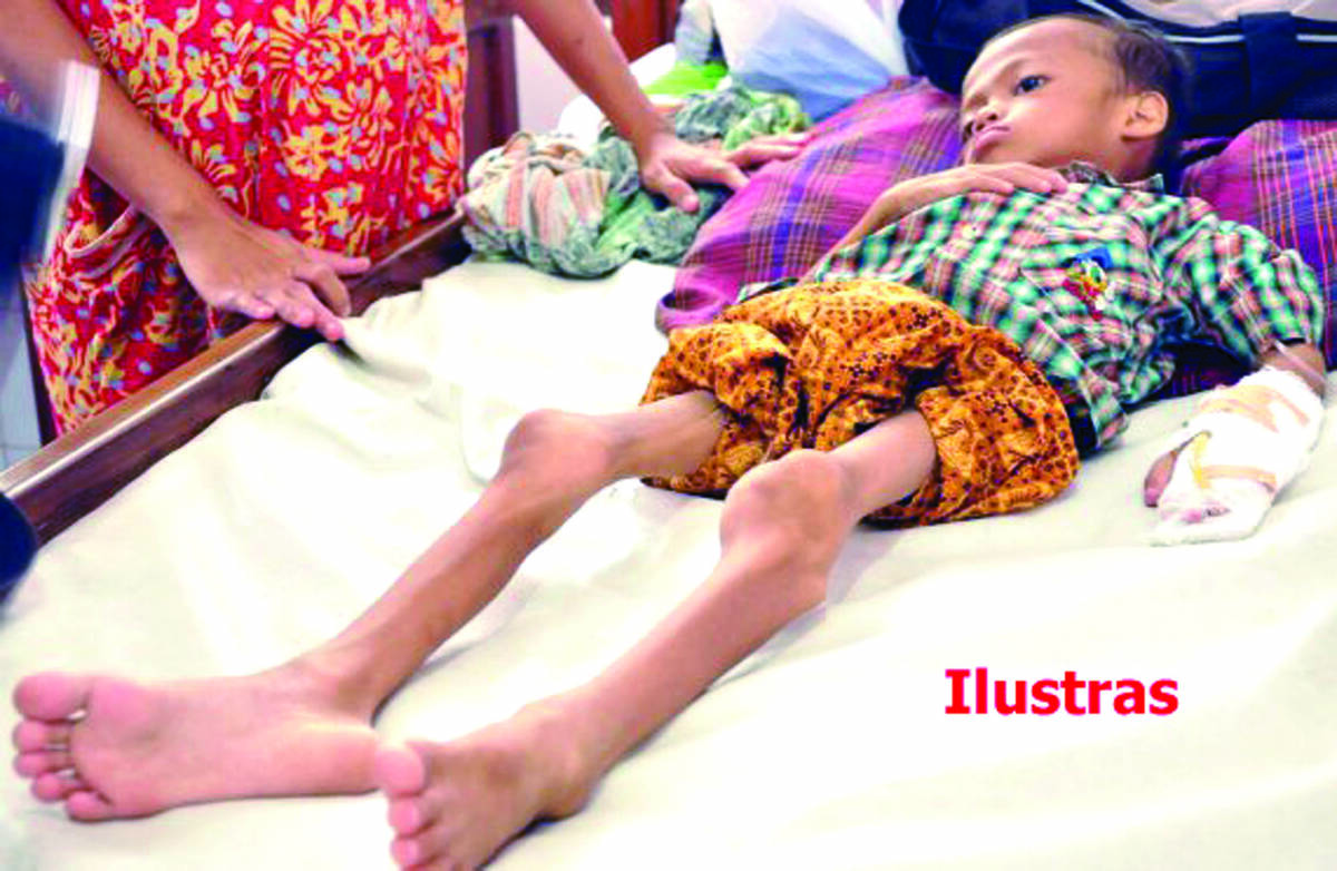 Sekda Berharap Kasus Gizi Buruk Dapat Teratasi