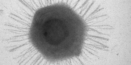 Wabah Virus Marburg Tak Kalah Bahaya dari Corona